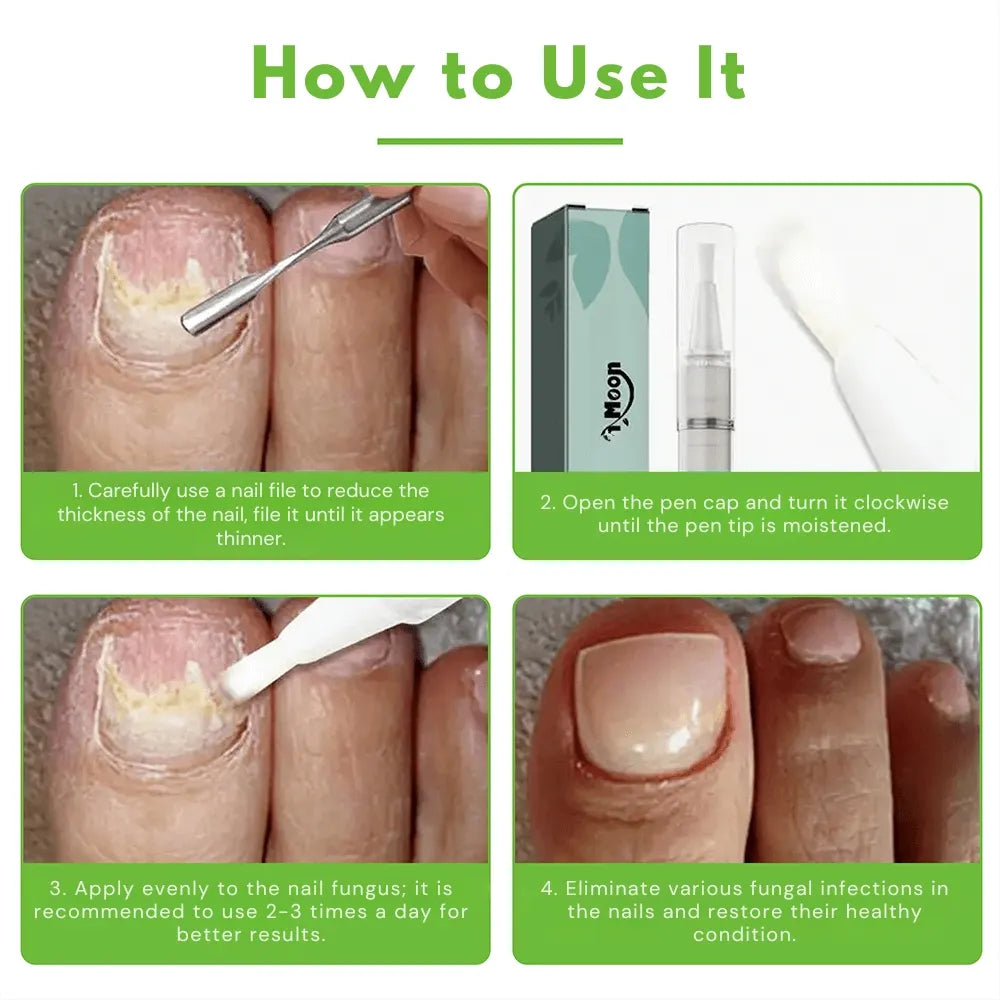 FungiGone® | Kill toenail fungus and bacteria and get healthier nails!